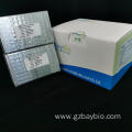 Virus nucleic acid extraction kit with CE